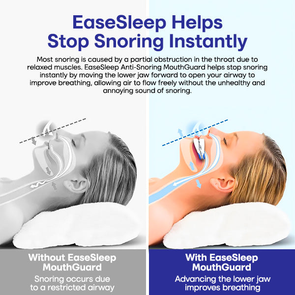 EaseSleep Pro Anti-Snoring MouthGuard