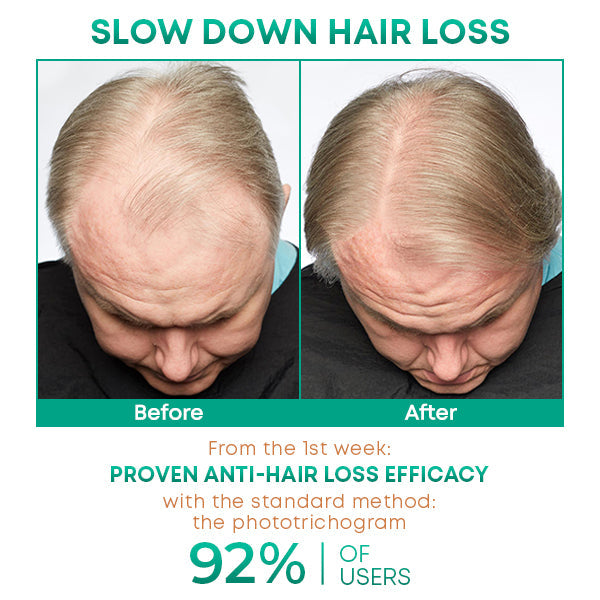 growTEX Anti-HairLoss Garlic Shampoo